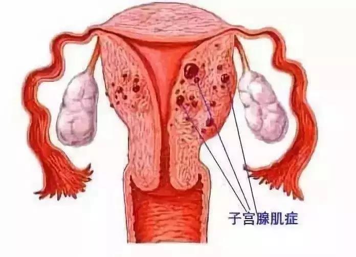 19岁女生每月3周痛经想切子宫，涉政问题的探讨